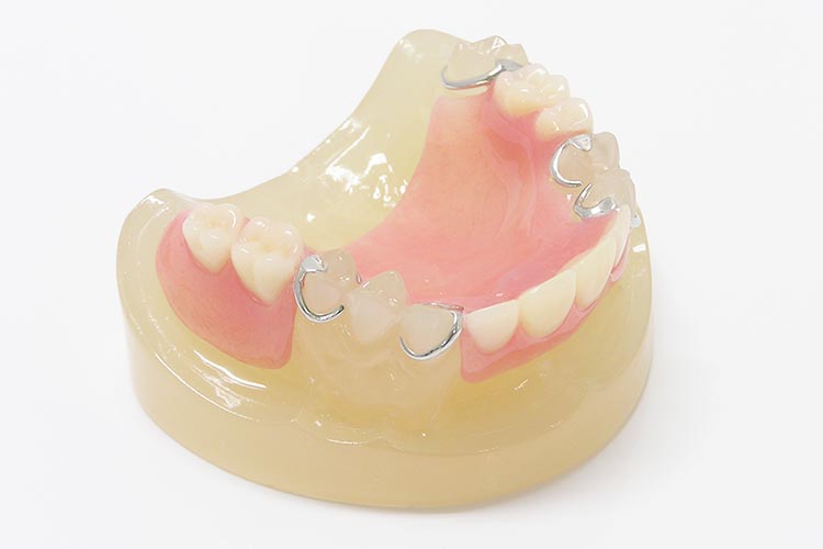 レジン床義歯（保険適用の入れ歯）